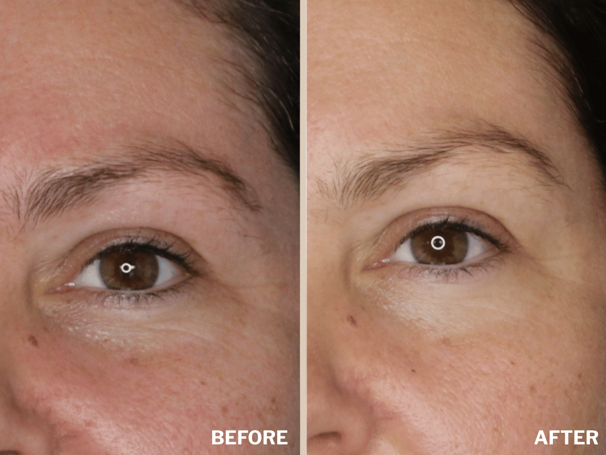 Firming Eye Contour Cream