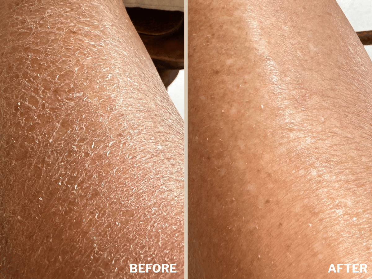 The Body Renewal Set