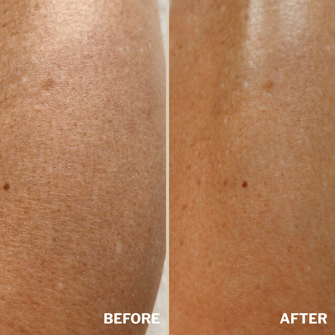 Skin Renewal Body Elixir