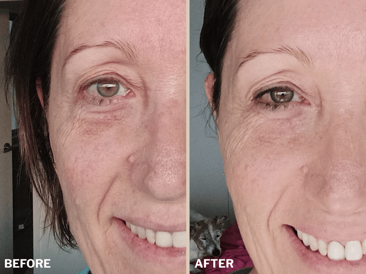 Ultra Rich Moisturiser