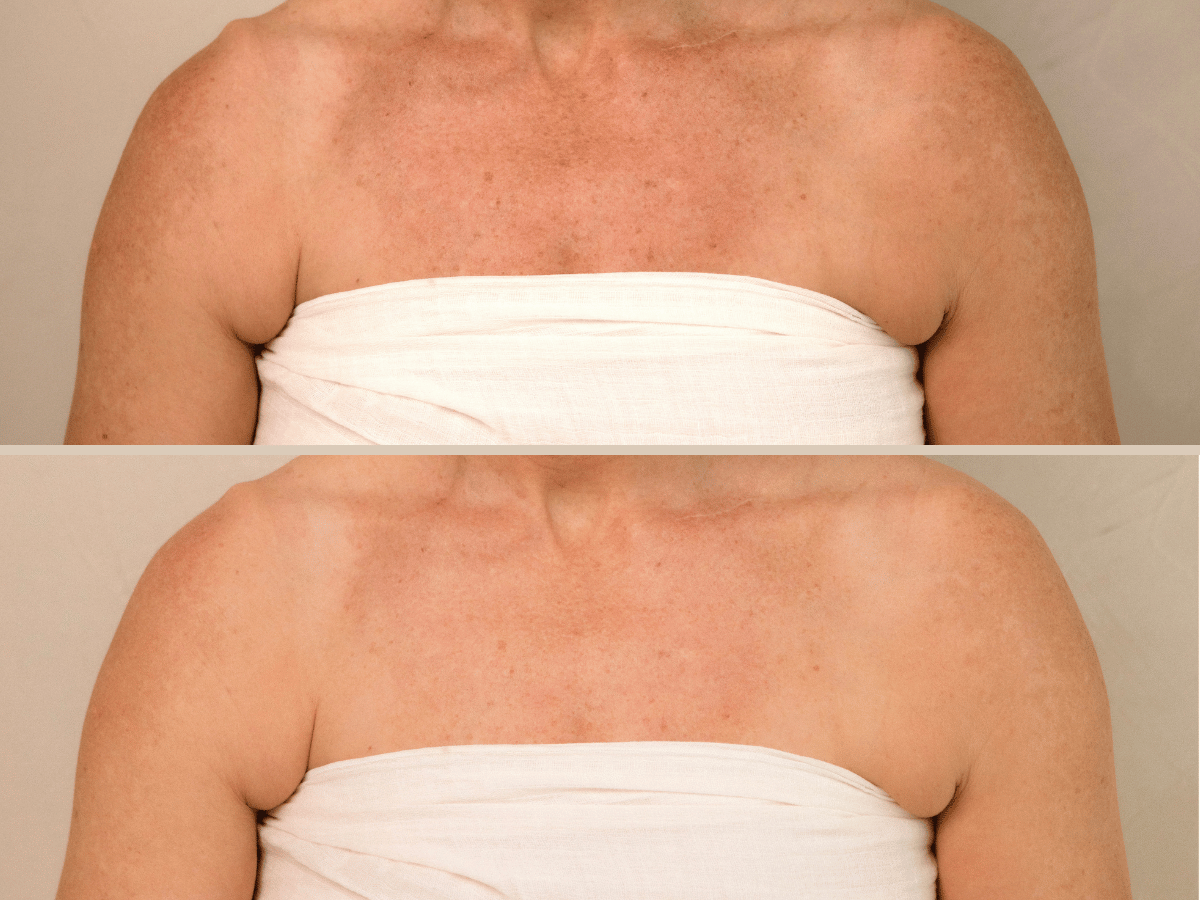 The Body Renewal Set