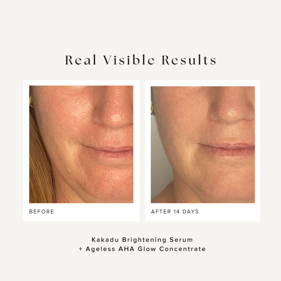Skin Brightening Bundle