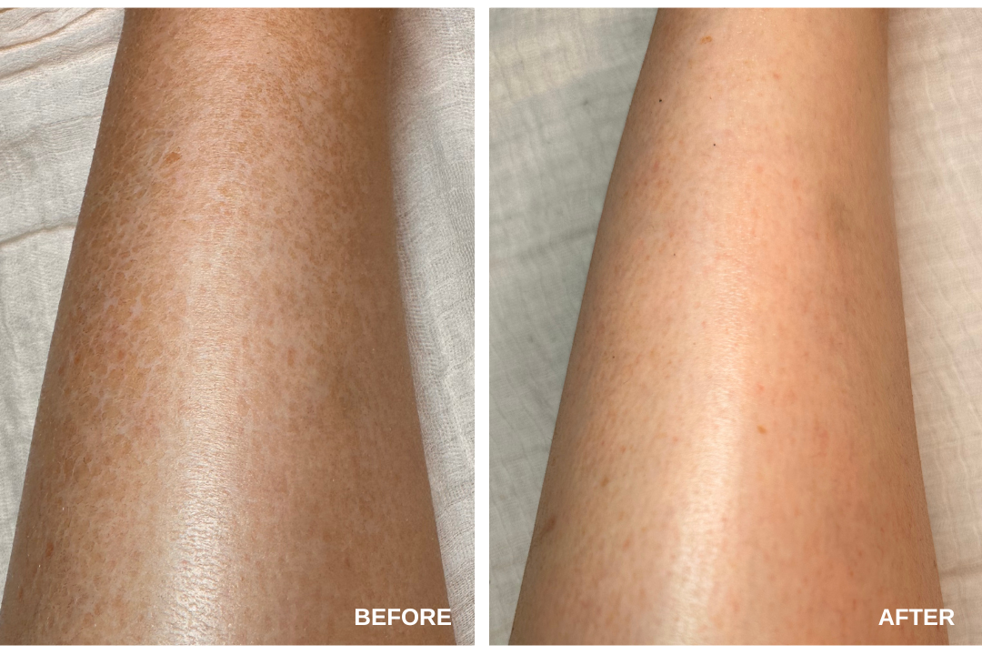 The Body Glow Ritual